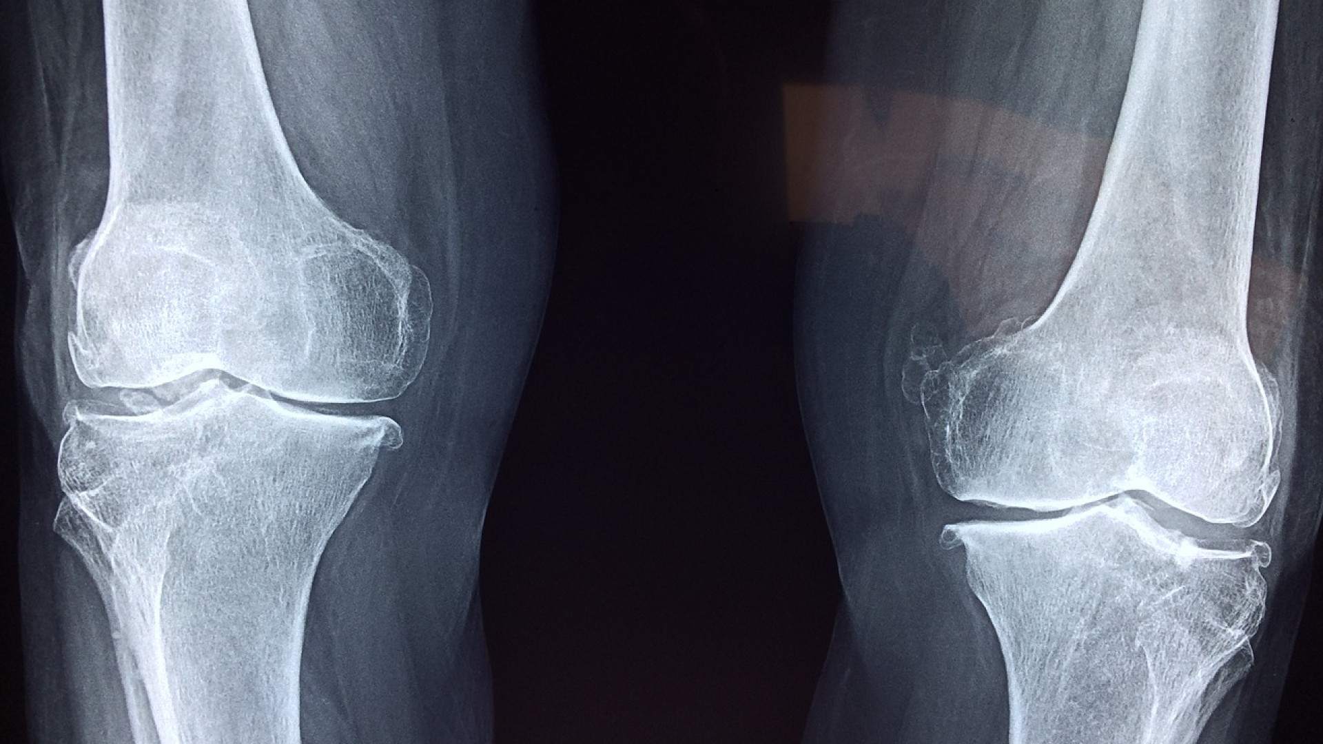 Comment devenir un chirurgien orthopédiste ?