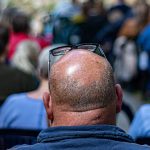 Quels sont les domaines d’intervention d’un expert de la chirurgie et du traitement de la calvitie ?